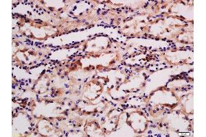 Formalin-fixed and paraffin embedded human kidney labeled with Rabbit Anti-phospho-PRKD3(Ser41) Polyclonal Antibody, Unconjugated  at 1:200 followed by conjugation to the secondary antibody and DAB staining (PRKD3 anticorps  (pSer41))