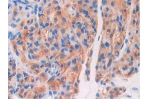 DAB staining on IHC-P; Samples: Mouse Ovary Tissue (Coagulation Factor V anticorps  (AA 364-611))
