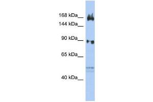 WB Suggested Anti-AFF2  Antibody Titration: 0.