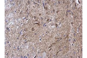 IHC-P Image NDUFV2 antibody detects NDUFV2 protein at mitochondria on mouse fore brain by immunohistochemical analysis.