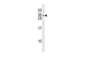IL28B Antibody (N-term) (ABIN1539309 and ABIN2848533) western blot analysis in SK-BR-3 cell line lysates (35 μg/lane).
