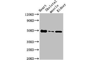 Western Blot Positive WB detected in: Rat heart tissue, Rat skeletal muscle, Mouse kidney tissue All lanes: ATP6V1C2 antibody at 3. (ATP6V1C2 anticorps  (AA 190-262))