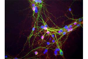 Mixed neuron-glial cultures stained with SNCA monoclonal antibody, clone 2A7 , our monoclonal antibody to SNCA (red) and chicken polylclonal antibody to MAP2 (green). (SNCA anticorps)