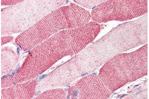 Human Skeletal Muscle (formalin-fixed, paraffin-embedded) stained with ARSB antibody ABIN337028 at 5 ug/ml followed by biotinylated anti-goat IgG secondary antibody ABIN481715, alkaline phosphatase-streptavidin and chromogen. (Arylsulfatase B anticorps  (AA 359-372))