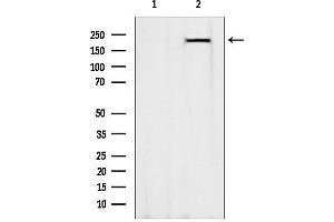 anti-Myosin Heavy Chain 7, Cardiac Muscle, beta (MYH7) (C-Term) antibody