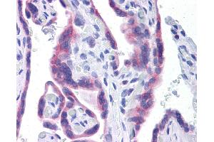 Anti-STT3A antibody IHC of human placenta. (STT3A anticorps  (AA 603-702))