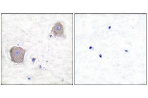 Immunohistochemistry (IHC) image for anti-Glutamate Receptor, Metabotropic 4 (GRM4) (C-Term) antibody (ABIN1848572) (Metabotropic Glutamate Receptor 4 anticorps  (C-Term))