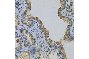 Immunohistochemistry of paraffin-embedded mouse lung using GLUL Antibody (ABIN5973158) at dilution of 1/100 (40x lens). (GLUL anticorps)