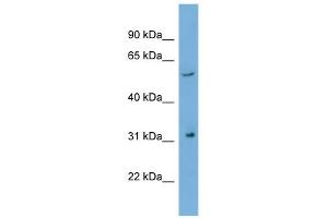 WB Suggested Anti-REM1 Antibody Titration: 0. (REM1 anticorps  (N-Term))