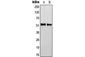 Western blot analysis of RGMB expression in HEK293T (A), NIH3T3 (B), H9C2 (C) whole cell lysates.