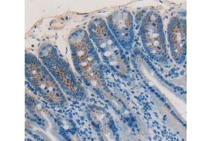 Used in DAB staining on fromalin fixed paraffin- embedded Kidney tissue (IGFBP4 anticorps  (AA 22-254))