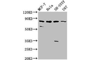 Western Blot Positive WB detected in: MCF-7 whole cell lysate, Hela whole cell lysate, SH-SY5Y whole cell lysate, U87 whole cell lysate All lanes: IL1RAPL1 antibody at 5. (IL1RAPL1 anticorps  (AA 564-679))