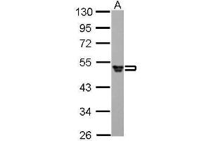 WB Image Fibrinogen gamma antibody detects FGG protein by Western blot analysis.