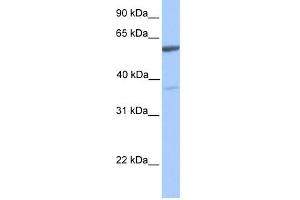 WB Suggested Anti-NAB2 Antibody Titration:  0. (NAB2 anticorps  (C-Term))