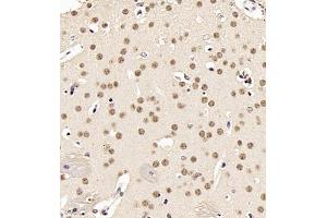 Immunohistochemistry of paraffin embedded mouse brain using UBE3A (ABIN7076105) at dilution of 1:500 (400x lens)