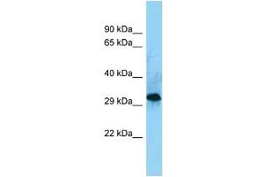 WB Suggested Anti-CD86 Antibody Titration: 1. (CD86 anticorps  (C-Term))