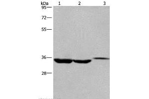 Western Blot analysis of Lovo cell,Human liver cancer tissue and Mouse kidney tissue using ING2 Polyclonal Antibody at dilution of 1:425 (ING2 anticorps)