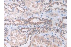 Detection of NCCT in Human Kidney Tissue using Polyclonal Antibody to Na-Cl Cotransporter (NCCT)