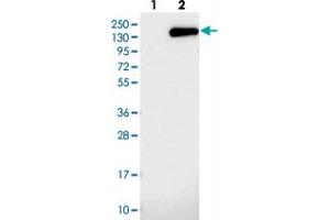 Western blot analysis of Lane 1: Negative control (vector only transfected HEK293T lysate), Lane 2: Over-expression Lysate (Co-expressed with a C-terminal myc-DDK tag (~3. (NUP155 anticorps)