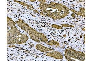 IHC analysis of MAT2A using anti-MAT2A antibody (ABIN7599120). (MAT2A anticorps  (AA 1-229))