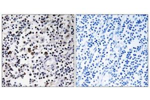 Immunohistochemistry analysis of paraffin-embedded human lymph node tissue using CD302 antibody. (DCL1 anticorps  (Internal Region))