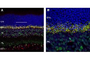 anti-Glutamate Receptor, Metabotropic 6 (GRM6) (AA 368-381), (Extracellular), (N-Term) antibody