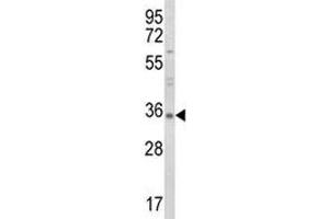 Western blot analysis of RANKL antibody and HL-60 lysate