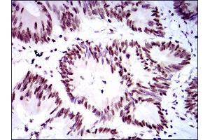 Immunohistochemistry (IHC) image for anti-Replication Protein A1, 70kDa (RPA1) antibody (ABIN1846411) (RPA1 anticorps)