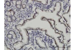 Image no. 2 for anti-Apoptosis Inhibitor 5 (API5) (AA 400-504) antibody (ABIN466131) (Apoptosis Inhibitor 5 anticorps  (AA 400-504))