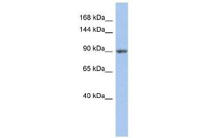 MAP4K5 antibody used at 1 ug/ml to detect target protein. (MAP4K5 anticorps  (Middle Region))