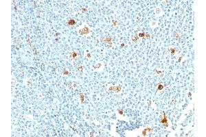 Formalin-fixed, paraffin-embedded human tonsil stained with Calprotectin Monoclonal Antibody (CPT/1028)