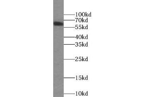 WB analysis of HepG2 cells subjected to SDS-PAGE, using PLAP antibody (1/1000 dilution). (PLAP anticorps)