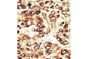 Image no. 2 for anti-WEE1 Homolog (S. Pombe) (WEE1) (C-Term) antibody (ABIN360579)