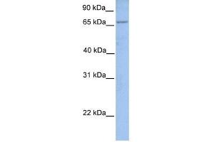 ACSL1 antibody used at 1 ug/ml to detect target protein.
