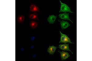 ABIN6265576 and ABIN6273176 staining HUVEC cells by IF/ICC. (TIMM44 anticorps  (N-Term))