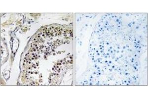 Immunohistochemistry analysis of paraffin-embedded human testis tissue, using CNOT4 Antibody.