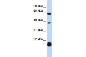 WB Suggested Anti-HTR3E Antibody Titration:  0. (HTR3E anticorps  (Middle Region))