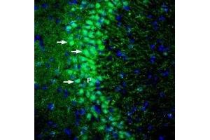 Expression of GKAP in rat hippocampus - Immunohistochemical staining of perfusion-fixed frozen rat brain sections with Anti-DLGAP1/GKAP Antibody (ABIN7043100, ABIN7045186 and ABIN7045187), (1:200), followed by goat anti-rabbit-AlexaFluor-488. (DLGAP1 anticorps  (Intracellular))