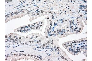 Immunohistochemical staining of paraffin-embedded Ovary tissue using anti-SSBmouse monoclonal antibody. (SSB anticorps)