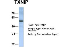 Host: Rabbit Target Name: TXNIP Sample Type: Human Adult Placenta Antibody Dilution: 1. (TXNIP anticorps  (C-Term))