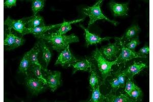 IF analysis of Fibrillarin/FBL using anti-Fibrillarin/FBL antibody (ABIN7602434).