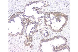 IHC analysis of RMI2 using anti-RMI2 antibody (ABIN6719656). (RMI2 anticorps)