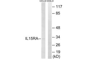 Western blot analysis of extracts from COLO cells, using IL15RA antibody.