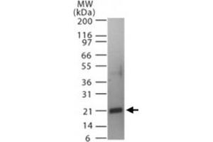 Western blot analysis of Tnfsf11 in a partial His-tagged recombinant protein. (RANKL anticorps  (AA 161-177))