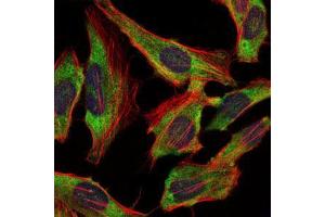 Immunofluorescence analysis of Hela cells using NEFL mouse mAb (green). (NEFL anticorps)