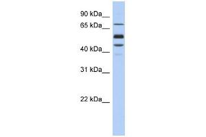 WB Suggested Anti-PROS1 Antibody Titration: 0. (PROS1 anticorps  (Middle Region))