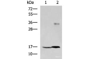 Western blot analysis of A172 cell and Human cerebrum tissue lysates using TMEM42 Polyclonal Antibody at dilution of 1:800 (TMEM42 anticorps)