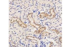 Immunohistochemistry analysis of paraffin-embedded mouse kidney using,MRP6 (ABIN7073149) at dilution of 1: 2000 (ABCC6 anticorps)
