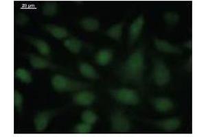 Immunostaining analysis in HeLa cells.