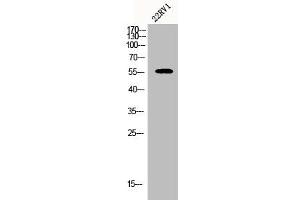 Western Blot analysis of 22RV1 cells using CYP2A7 Polyclonal Antibody